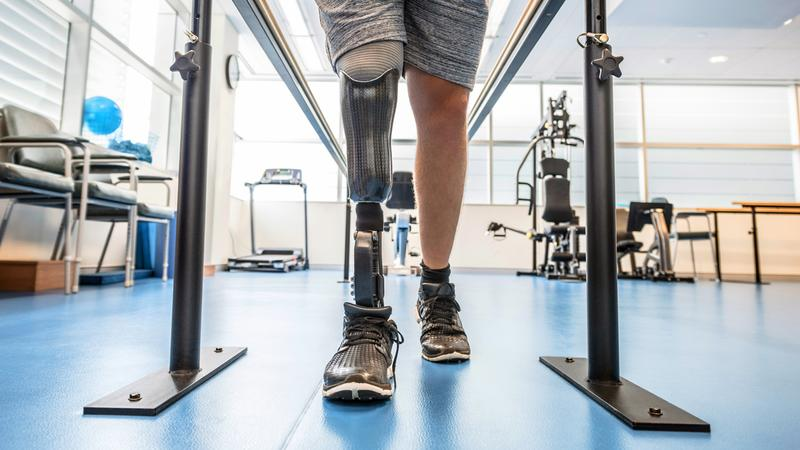 How Prosthetics Services Enhance Quality of Life After Limb Loss